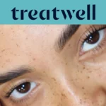 &Tau;&iota;&rho;&kappa;&omicron;&upsilon;ά&zeta; banner &tau;&eta;&sigmaf; Treatwell &mu;&epsilon; &kappa;&omicron;&nu;&tau;&iota;&nu;ό &pi;&lambda;ά&nu;&omicron; &sigma;&epsilon; &phi;&upsilon;&sigma;&iota;&kappa;ά &alpha;&nu;&alpha;&sigma;&eta;&kappa;&omega;&mu;έ&nu;&epsilon;&sigmaf; &beta;&lambda;&epsilon;&phi;&alpha;&rho;ί&delta;&epsilon;&sigmaf; &mu;&epsilon;&tau;ά &alpha;&pi;ό korean lash lift, &pi;ά&nu;&omega; &sigma;&epsilon; &delta;έ&rho;&mu;&alpha; &mu;&epsilon; &phi;&alpha;&kappa;ί&delta;&epsilon;&sigmaf;
