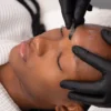 Κοντινό πλάνο μιας αισθητικού που κάνει dermaplaning σε μια πελάτισσα σε κέντρο αισθητικής