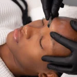 Κοντινό πλάνο μιας αισθητικού που κάνει dermaplaning σε μια πελάτισσα σε κέντρο αισθητικής